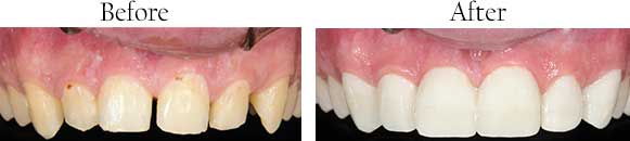 dental images in Woburn