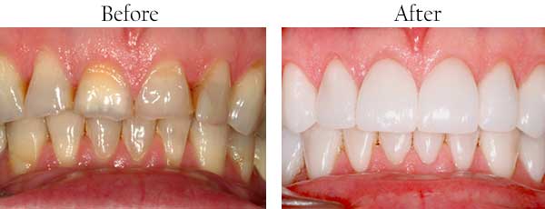 dental images zip1